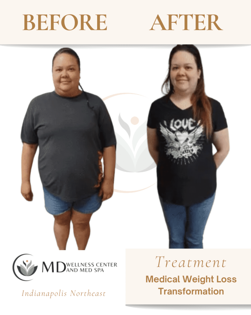 vitamin b12 injections weight loss reviews Medical | Lipotropic Shots ✨ What is AOD doctor-only Milligrams:10mg