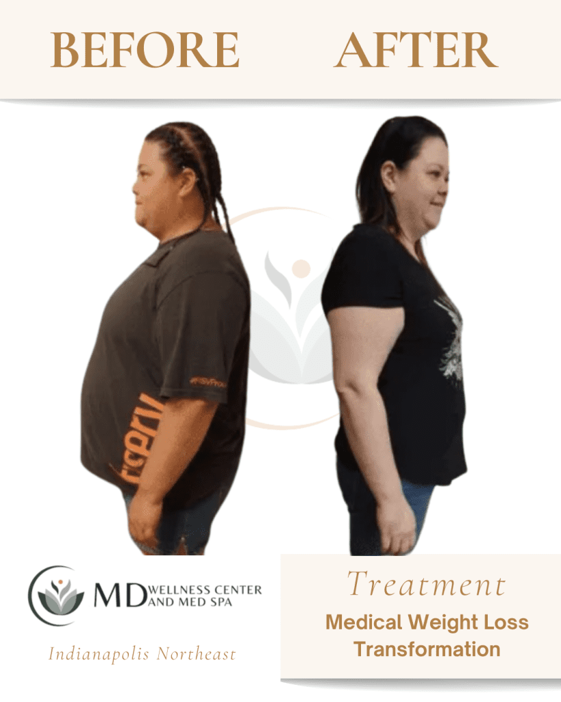 b12 injections vs pills weight loss Medical | Lipotropic Shots 7 peptides under FDA energy-longevity Net Weight:5mg