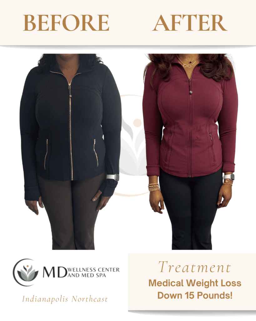 glp-1 weight loss clinic colorado springs Medical  GLP-1 Medical Weight Loss