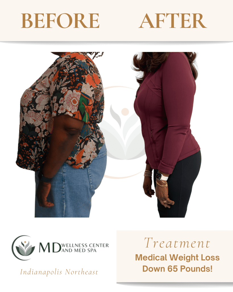 Medical Weight Loss | Lipotropic B12 Shots