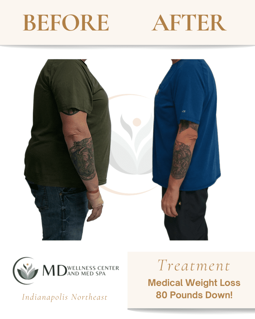glp-1 indianapolis GLP-1 Weight Loss Injections in Indianapolis