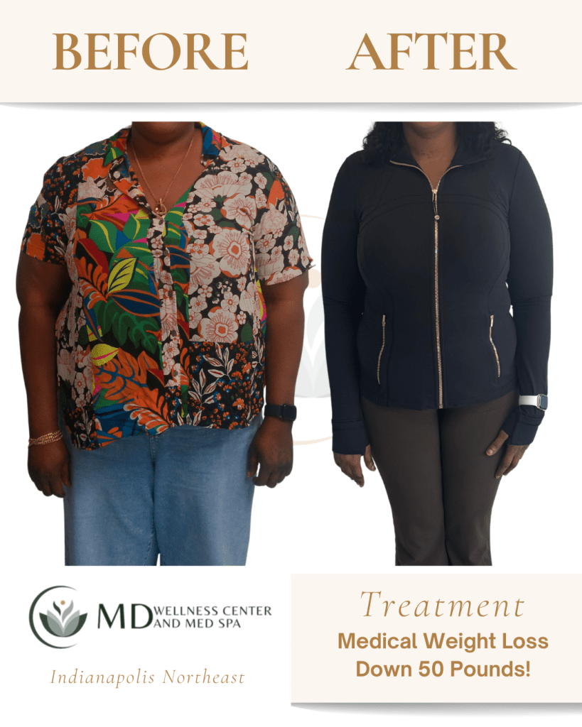 indianapolis semaglutide weight loss indianapolis GLP-1 Weight Loss Injections in Indianapolis