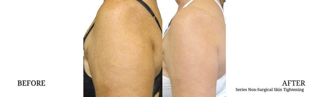 target glp 1 GLP-1R: Therapeutic Target for Obesity and Metabolic Disorders