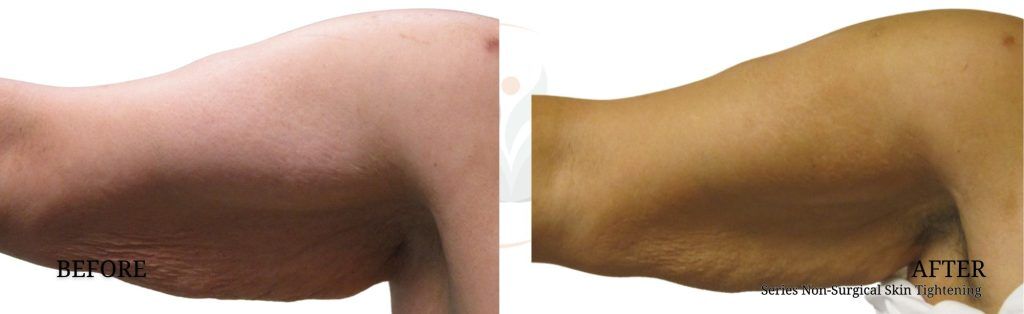 best online glp-1 program reviews Patients seeking cheaper weight-loss drugs online find questionable  products : Shots