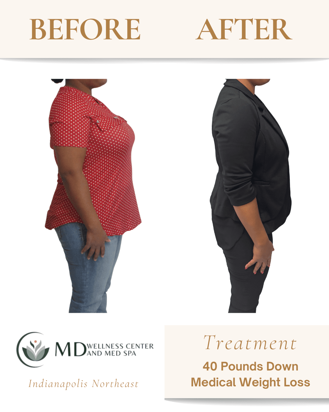 lipotropic b12 injections before and after B12 Lipotropic Injections for Weight Loss - Burn Fat, Boost Energy, Lower  Cholesterol, Doctor Supervised