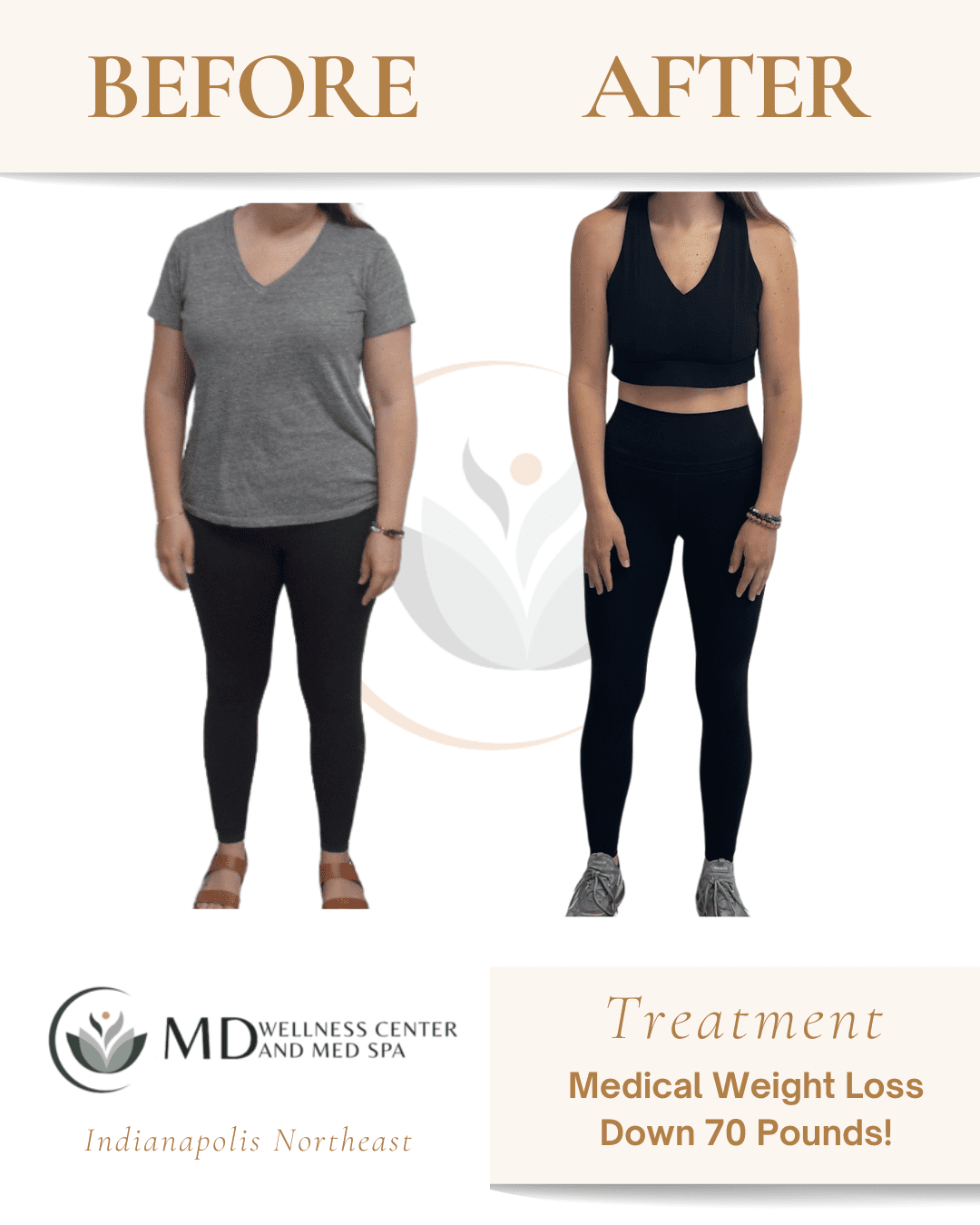 Medical Weight Loss | Lipotropic B12 Shots