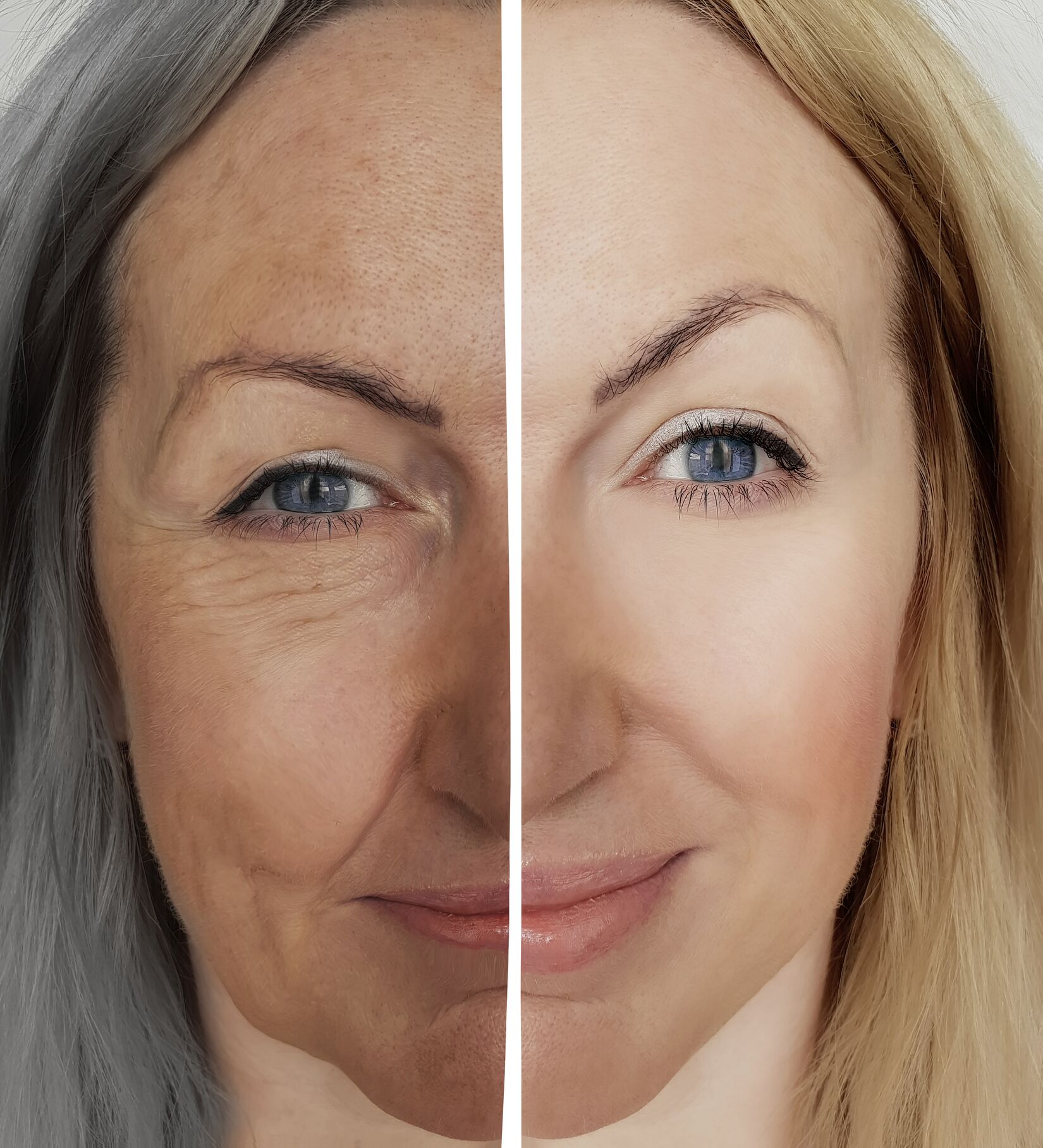 glp 1 same as semaglutide GLP-1 receptor agonists